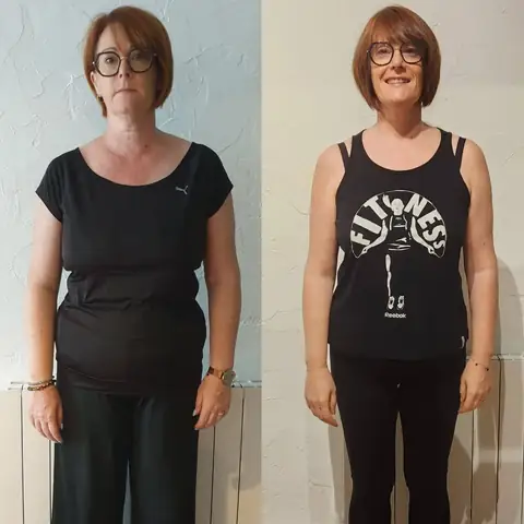 Montage avant-après d’une membre d’Anjou Nutrition, cadrée de face