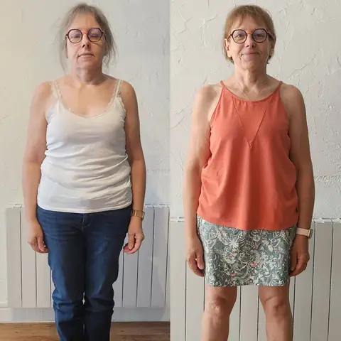 Montage avant-après d’une membre d’Anjou Nutrition, cadrée de face