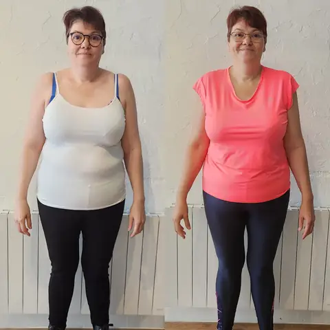 Montage avant-après d’une membre d’Anjou Nutrition, cadrée de face